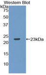 RPP40 / Ribonuclease P Antibody - Western blot of recombinant RPP40.  This image was taken for the unconjugated form of this product. Other forms have not been tested.