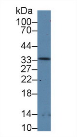 RPP40 / Ribonuclease P Antibody - Western Blot; Sample: Rat Stomach lysate; Primary Ab: 5µg/ml Rabbit Anti-Rat RNASEP Antibody Second Ab: 0.2µg/mL HRP-Linked Caprine Anti-Rabbit IgG Polyclonal Antibody