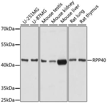 RPP40 / Ribonuclease P Antibody - Western blot analysis of extracts of various cell lines using RPP40 Polyclonal Antibody at dilution of 1:1000.