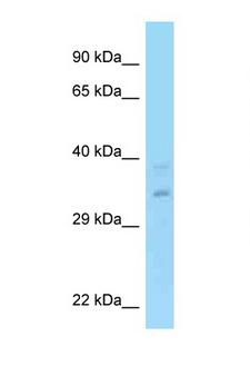 RPRD1A Antibody - RPRD1A antibody Western blot of Fetal Lung lysate. Antibody concentration 1 ug/ml.  This image was taken for the unconjugated form of this product. Other forms have not been tested.
