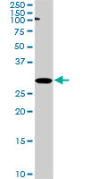 RPRD1A Antibody - P15RS monoclonal antibody (M01), clone 1B8. Western blot of P15RS expression in PC-12.
