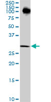 RPRD1A Antibody - P15RS monoclonal antibody (M01), clone 1B8. Western blot of P15RS expression in NIH/3T3.
