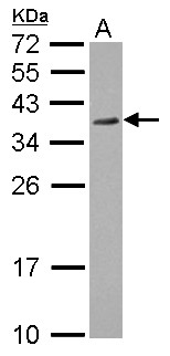 RPRD1A Antibody - Sample (30 ug of whole cell lysate) A: HCT116 12% SDS PAGE RPRD1A antibody diluted at 1:1000