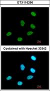 RPRD1A Antibody - Immunofluorescence of paraformaldehyde-fixed A549, using P15RS antibody at 1:500 dilution.