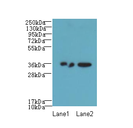 RPRD1A Antibody - Western blot. All lanes: RPRD1A antibody at 2 ug/ml. Lane 1: A431 whole cell lysate. Lane 2: Jurkat whole cell lysate. Secondary Goat polyclonal to Rabbit IgG at 1:10000 dilution. Predicted band size: 36 kDa. Observed band size: 36 kDa.