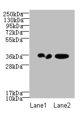 RPRD1A Antibody - Western blot All lanes: RPRD1A antibody at 2µg/ml Lane 1: A431 whole cell lysate Lane 2: Jurkat whole cell lysate Secondary Goat polyclonal to rabbit IgG at 1/10000 dilution Predicted band size: 36, 32 kDa Observed band size: 36 kDa
