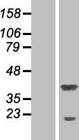 RPRD1A Protein - Western validation with an anti-DDK antibody * L: Control HEK293 lysate R: Over-expression lysate