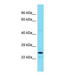 RPRD1B Antibody - Western blot of Mouse Testis. Rprd1b antibody dilution 1.0 ug/ml.  This image was taken for the unconjugated form of this product. Other forms have not been tested.