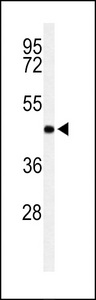 RPRD1B Antibody - Western blot of RPR1B Antibody in Jurkat cell line lysates (35 ug/lane). RPR1B (arrow) was detected using the purified antibody.