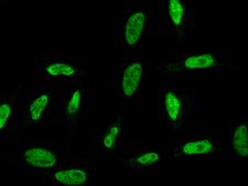 RPRD1B Antibody - Immunofluorescence staining of RPRD1B in Hela cells. Cells were fixed with 4% PFA, permeabilzed with 0.1% Triton X-100 in PBS, blocked with 10% serum, and incubated with mouse anti-Human RPRD1B monoclonal antibody (dilution ratio 1:60) at 4°C overnight. Then cells were stained with the Alexa Fluor 488-conjugated Goat Anti-mouse IgG secondary antibody (green). Positive staining was localized to Nucleus.