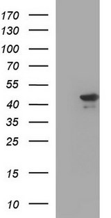 RPRD1B Antibody - HEK293T cells were transfected with the pCMV6-ENTRY control (Left lane) or pCMV6-ENTRY RPRD1B (Right lane) cDNA for 48 hrs and lysed. Equivalent amounts of cell lysates (5 ug per lane) were separated by SDS-PAGE and immunoblotted with anti-RPRD1B.