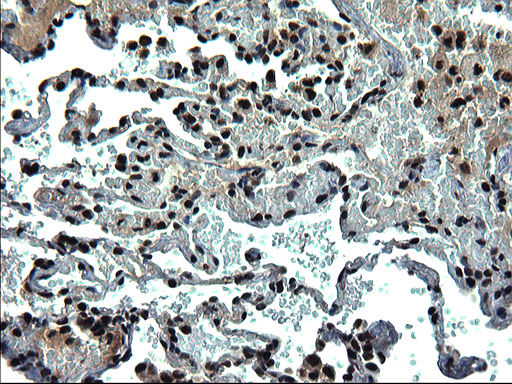 RPRD1B Antibody - IHC of paraffin-embedded Human lung tissue using anti-RPRD1B mouse monoclonal antibody. (Heat-induced epitope retrieval by 1 mM EDTA in 10mM Tris, pH8.5, 120°C for 3min).