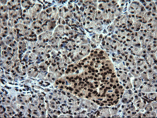 RPRD1B Antibody - IHC of paraffin-embedded Human pancreas tissue using anti-RPRD1B mouse monoclonal antibody. (Heat-induced epitope retrieval by 1 mM EDTA in 10mM Tris, pH8.5, 120°C for 3min).