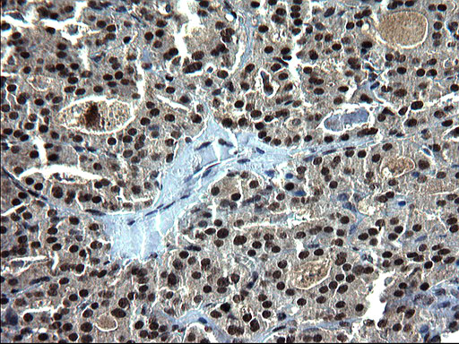 RPRD1B Antibody - IHC of paraffin-embedded Human thyroid tissue using anti-RPRD1B mouse monoclonal antibody. (Heat-induced epitope retrieval by 1 mM EDTA in 10mM Tris, pH8.5, 120°C for 3min).
