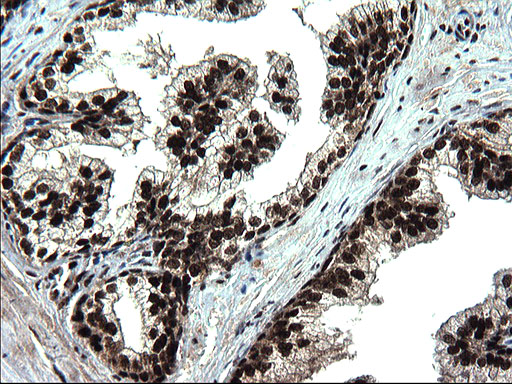 RPRD1B Antibody - IHC of paraffin-embedded Human prostate tissue using anti-RPRD1B mouse monoclonal antibody. (Heat-induced epitope retrieval by 1 mM EDTA in 10mM Tris, pH8.5, 120°C for 3min).