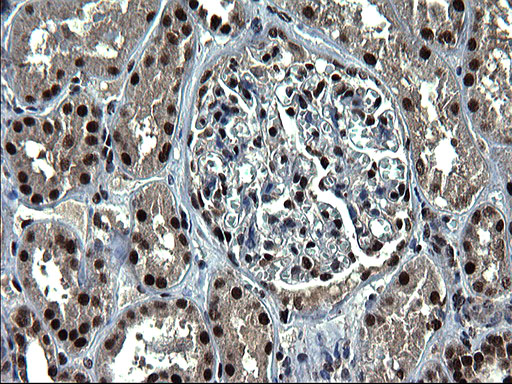 RPRD1B Antibody - IHC of paraffin-embedded Human Kidney tissue using anti-RPRD1B mouse monoclonal antibody. (Heat-induced epitope retrieval by 1 mM EDTA in 10mM Tris, pH8.5, 120°C for 3min).