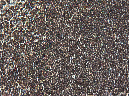 RPRD1B Antibody - IHC of paraffin-embedded Human lymph node tissue using anti-RPRD1B mouse monoclonal antibody. (Heat-induced epitope retrieval by 1 mM EDTA in 10mM Tris, pH8.5, 120°C for 3min).