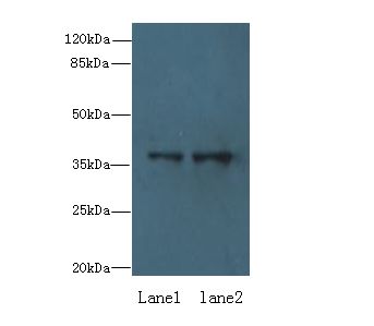RPRD1B Antibody - Western blot. All lanes: RPRD1B antibody at 0.2 ug/ml. Lane 1: Jurkat whole cell lysate. Lane 2: 293T whole cell lysate. Secondary Goat polyclonal to Rabbit IgG at 1:10000 dilution. Predicted band size: 37 kDa. Observed band size: 37 kDa.
