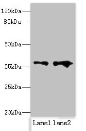 RPRD1B Antibody - Western blot All lanes: RPRD1B antibody at 0.2µg/ml Lane 1: Jurkat whole cell lysate Lane 2: 293T whole cell lysate Secondary Goat polyclonal to rabbit IgG at 1/10000 dilution Predicted band size: 37 kDa Observed band size: 37 kDa