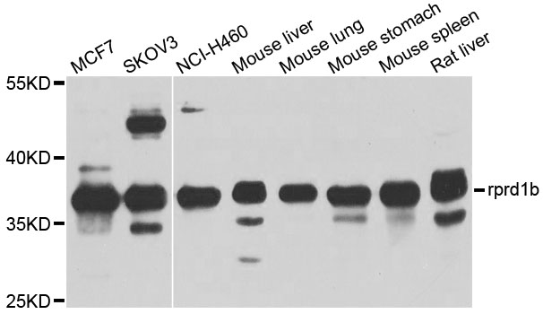RPRD1B Antibody - Western blot analysis of extracts of various cell lines, using rprd1b antibody at 1:1000 dilution. The secondary antibody used was an HRP Goat Anti-Rabbit IgG (H+L) at 1:10000 dilution. Lysates were loaded 25ug per lane and 3% nonfat dry milk in TBST was used for blocking. An ECL Kit was used for detection and the exposure time was 15s.