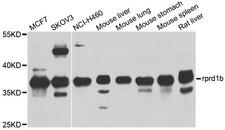 RPRD1B Antibody - Western blot analysis of extracts of various cell lines, using rprd1b antibody at 1:1000 dilution. The secondary antibody used was an HRP Goat Anti-Rabbit IgG (H+L) at 1:10000 dilution. Lysates were loaded 25ug per lane and 3% nonfat dry milk in TBST was used for blocking. An ECL Kit was used for detection and the exposure time was 15s.