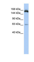 RPRD2 Antibody - RPRD2 antibody Western blot of HepG2 cell lysate. This image was taken for the unconjugated form of this product. Other forms have not been tested.