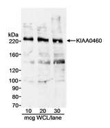 RPRD2 Antibody - Detection of Human KIAA0460 by Western Blot. Samples: Whole cell lysate (WCL; amounts indicated) from HeLa cells. Antibody: Affinity purified goat anti-KIAA0460 antibody used at 1 ug/ml. Detection: Chemiluminescence with 3 minute exposure.