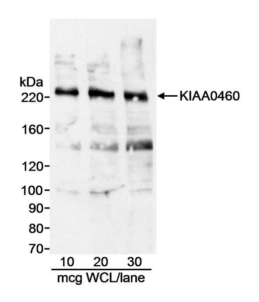 RPRD2 Antibody - Detection of Human KIAA0460 by Western Blot. Samples: Whole cell lysate (WCL; amounts indicated) from HeLa cells. Antibody: Affinity purified goat anti-KIAA0460 antibody used at 1 ug/ml. Detection: Chemiluminescence with 3 minute exposure.