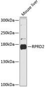 RPRD2 Antibody - Western blot analysis of extracts of mouse liver using RPRD2 Polyclonal Antibody at dilution of 1:3000.