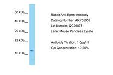 RPRML Antibody -  This image was taken for the unconjugated form of this product. Other forms have not been tested.