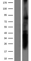 RPRML Protein - Western validation with an anti-DDK antibody * L: Control HEK293 lysate R: Over-expression lysate