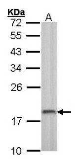 RPS10 / Ribosomal Protein S10 Antibody - Sample (30 ug of whole cell lysate). A: A431 . 12% SDS PAGE. RPS10 antibody diluted at 1:1000.