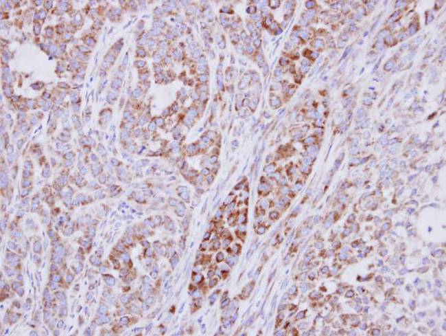RPS10 / Ribosomal Protein S10 Antibody - IHC of paraffin-embedded A549 xenograft using RPS10 antibody at 1:500 dilution.