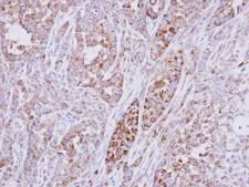 RPS10 / Ribosomal Protein S10 Antibody - IHC of paraffin-embedded A549 xenograft using RPS10 antibody at 1:500 dilution.