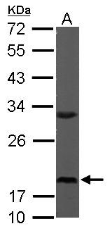 RPS10 / Ribosomal Protein S10 Antibody - Sample (50 ug of whole cell lysate). A: Mouse brain. 12% SDS PAGE. RPS10 antibody diluted at 1:1000.