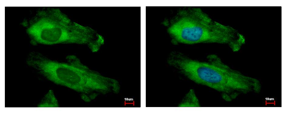 RPS10 / Ribosomal Protein S10 Antibody - RPS10 antibody detects RPS10 protein at cytoplasm by immunofluorescent analysis. HeLa cells were fixed in 4% paraformaldehyde at RT for 15 min. RPS10 protein stained by RPS10 antibody diluted at 1:500.