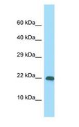 RPS10 / Ribosomal Protein S10 Antibody - RPS10 / S10 antibody Western Blot of Jurkat.  This image was taken for the unconjugated form of this product. Other forms have not been tested.