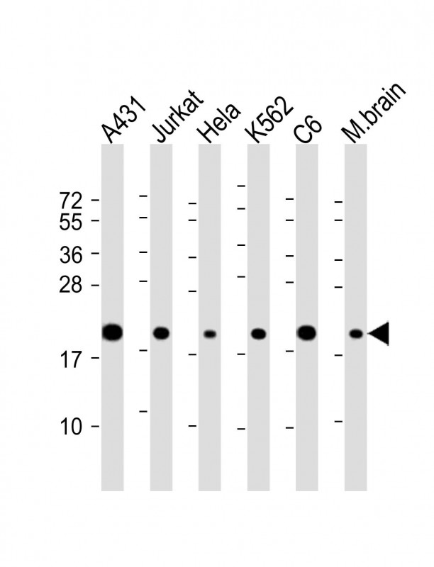 RPS10 / Ribosomal Protein S10 Antibody - All lanes: Anti-RPS10 Antibody (C-Term) at 1:2000 dilution Lane 1: A431 whole cell lysate Lane 2: Jurkat whole cell lysate Lane 3: Hela whole cell lysate Lane 4: K562 whole cell lysate Lane 5: C6 whole cell lysate Lane 6: mouse brain lysate Lysates/proteins at 20 µg per lane. Secondary Goat Anti-Rabbit IgG, (H+L), Peroxidase conjugated at 1/10000 dilution. Predicted band size: 19 kDa Blocking/Dilution buffer: 5% NFDM/TBST.