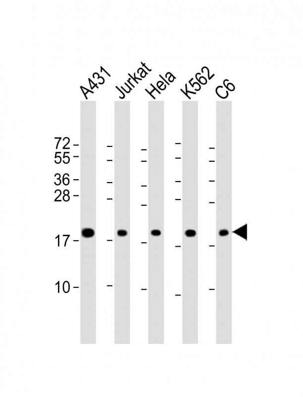 RPS10 / Ribosomal Protein S10 Antibody - All lanes: Anti-RPS10 Antibody (Center) at 1:2000 dilution Lane 1: A431 whole cell lysate Lane 2: Jurkat whole cell lysate Lane 3: Hela whole cell lysate Lane 4: K562 whole cell lysate Lane 5: C6 whole cell lysate Lysates/proteins at 20 µg per lane. Secondary Goat Anti-Rabbit IgG, (H+L), Peroxidase conjugated at 1/10000 dilution. Predicted band size: 19 kDa Blocking/Dilution buffer: 5% NFDM/TBST.