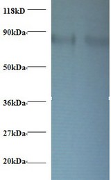 RPS10 / Ribosomal Protein S10 Antibody - Western blot of 40s ribosomal protein S10 antibody at 2 ug/ml. Lane 1: EC109whole cell lysate. Lane 2: 293T whole cell lysate. Secondary: Goat polyclonal to Rabbit IgG at 1:15000 dilution. Predicted band size: 18.1 kDa. Observed band size: 80 kDa.  This image was taken for the unconjugated form of this product. Other forms have not been tested.