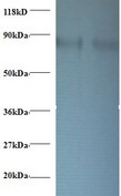 RPS10 / Ribosomal Protein S10 Antibody - Western blot of 40s ribosomal protein S10 antibody at 2 ug/ml. Lane 1: EC109whole cell lysate. Lane 2: 293T whole cell lysate. Secondary: Goat polyclonal to Rabbit IgG at 1:15000 dilution. Predicted band size: 18.1 kDa. Observed band size: 80 kDa.  This image was taken for the unconjugated form of this product. Other forms have not been tested.