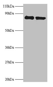 RPS10 / Ribosomal Protein S10 Antibody - Western blot All lanes: 40s ribosomal protein S10 ntibody at 2µg/ml Lane 1: EC109whole cell lysate Lane 2: 293T whole cell lysate Secondary Goat polyclonal to rabbit IgG at 1/15000 dilution Predicted band size: 18.1 kDa Observed band size: 80 kDa