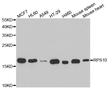 RPS10 / Ribosomal Protein S10 Antibody - Western blot analysis of extracts of various cell lines.
