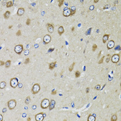 RPS10 / Ribosomal Protein S10 Antibody - Immunohistochemistry of paraffin-embedded rat brain tissue.