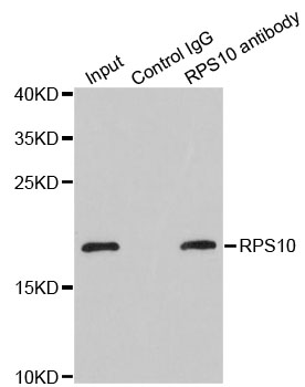 RPS10 / Ribosomal Protein S10 Antibody - Immunoprecipitation analysis of 200ug extracts of MCF-7 cells.