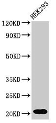 RPS10 / Ribosomal Protein S10 Antibody - Positive Western Blot detected in HEK293 whole cell lysate. All lanes: RPS10P5 antibody at 2 µg/ml Secondary Goat polyclonal to rabbit IgG at 1/50000 dilution. Predicted band size: 21 KDa. Observed band size: 21 KDa