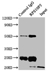 RPS10 / Ribosomal Protein S10 Antibody - Immunoprecipitating RPS10P5 in HEK293 whole cell lysate Lane 1: Rabbit control IgG instead of RPS10P5 Antibody in HEK293 whole cell lysate.For western blotting, a HRP-conjugated Protein G antibody was used as the secondary antibody (1/2000) Lane 2: RPS10P5 Antibody (8µg) + HEK293 whole cell lysate (500µg) Lane 3: HEK293 whole cell lysate (10µg)
