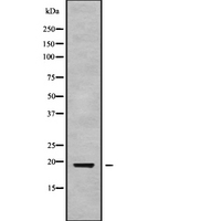 RPS10 / Ribosomal Protein S10 Antibody - Western blot analysis of RPS10 using HuvEc whole cells lysates