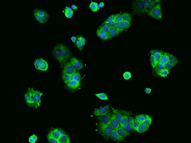 RPS10 / Ribosomal Protein S10 Antibody - Immunofluorescence staining of RPS10 in MCF7 cells. Cells were fixed with 4% PFA, permeabilzed with 0.1% Triton X-100 in PBS, blocked with 10% serum, and incubated with rabbit anti-Human RPS10 polyclonal antibody (dilution ratio 1:200) at 4°C overnight. Then cells were stained with the Alexa Fluor 488-conjugated Goat Anti-rabbit IgG secondary antibody (green) and counterstained with DAPI (blue). Positive staining was localized to Cytoplasm.