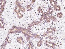 RPS10 / Ribosomal Protein S10 Antibody - Immunochemical staining of human RPS10 in human breast with rabbit polyclonal antibody at 1:100 dilution, formalin-fixed paraffin embedded sections.